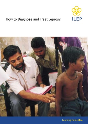 How to diagnose and treat leprosy
