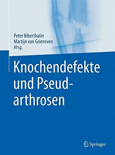 Knochendefekte und Pseudarthrosen