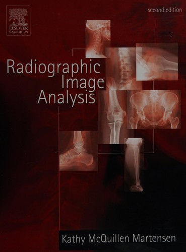 Radiographic image analysis