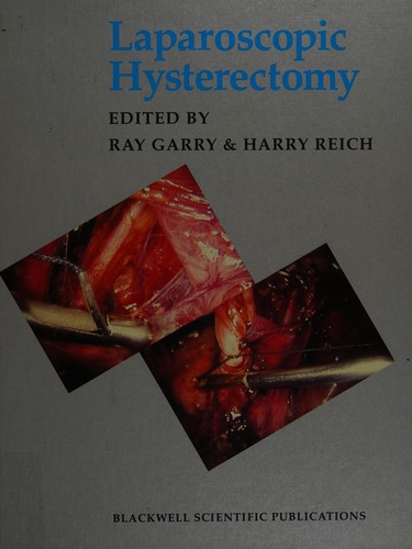Laparoscopic hysterectomy