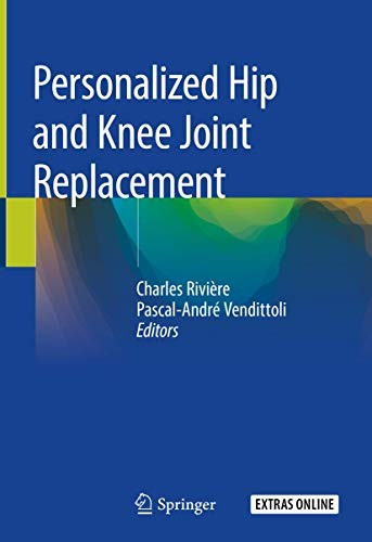 Personalized Hip and Knee Joint Replacement