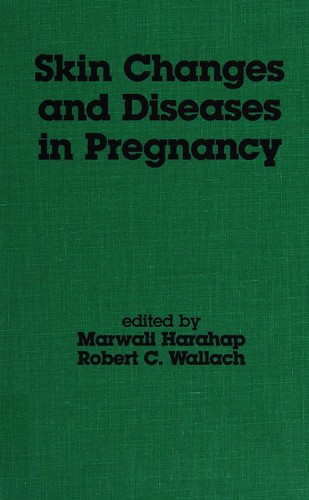 Skin changes and diseases in pregnancy