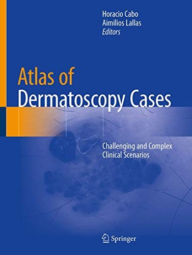 Atlas of Dermatoscopy Cases