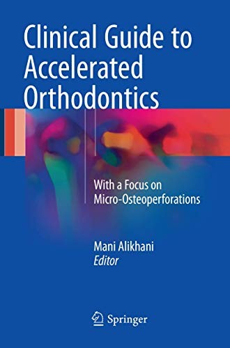 Clinical Guide to Accelerated Orthodontics
