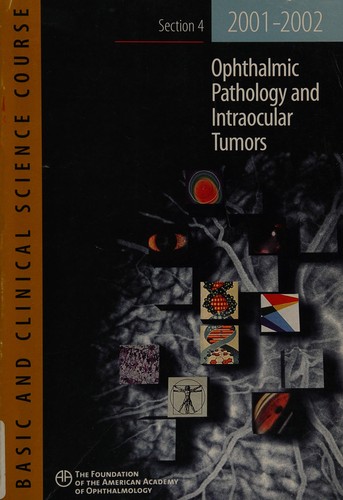 Ophthalmic pathology and intraocular tumors