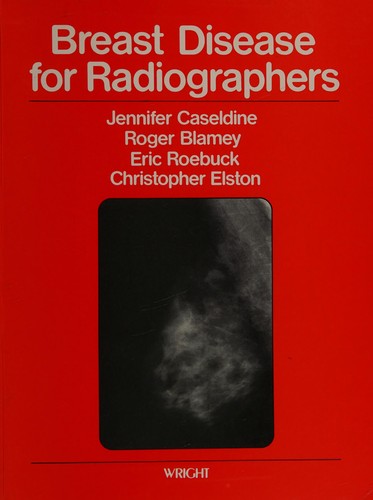 Breast disease for radiographers