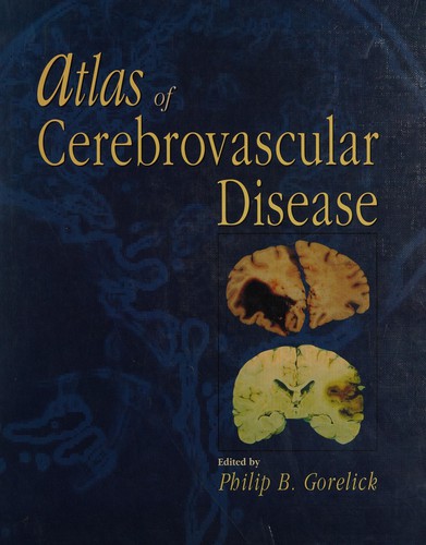 Atlas of Cerebrovascular Disease (Current Medicine Title)