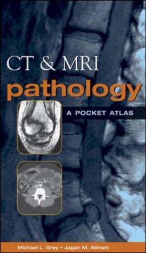 CT and MRI Pathology