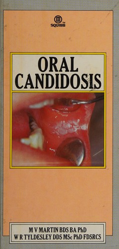 Oral candidosis