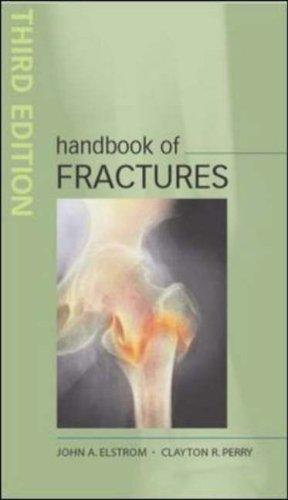 Handbook of fractures