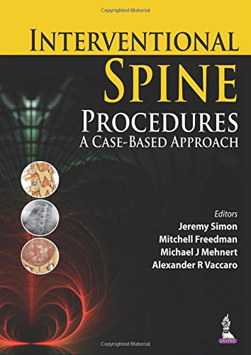 Interventional Spine Procedures