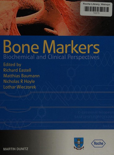 Bone Markers