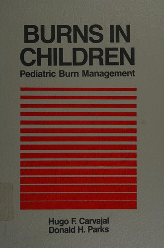 Burns in children