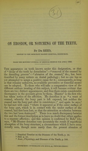 On erosion, or notching of the teeth