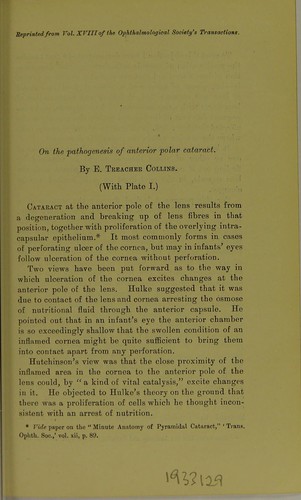 On the pathogenesis of anterior polar cataract
