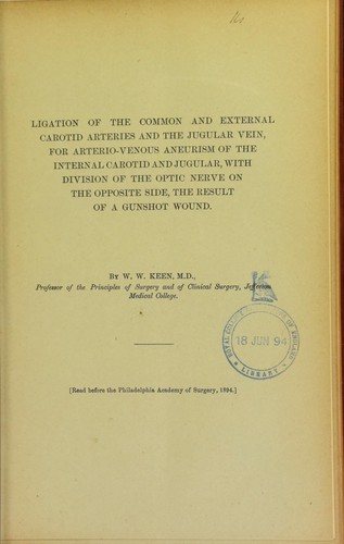 Ligation of the common and external carotid arteries and the jugular vein, for arterio-venous aneurism of the internal carotid and jugular, with division of the optic nerve on the opposite side, the result of a gunshot wound