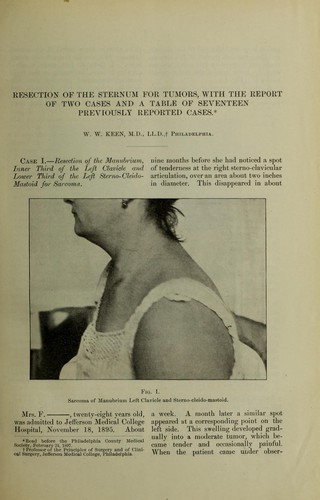 Resection of the sternum for tumors
