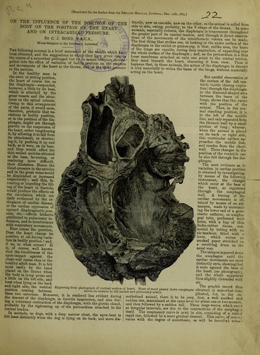 On the influence of the position of the body on the position of the heart and on intracardiac pressure