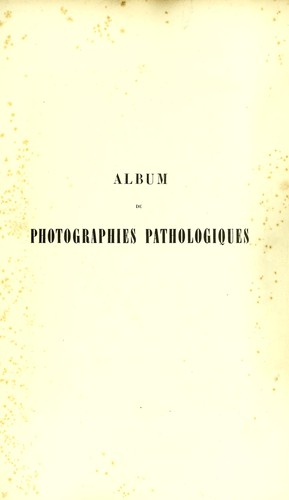 Album de photographies pathologiques complémentaire du livre intitulé De l'électrisation localisée