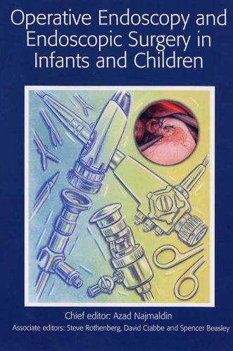 Endoscopic surgery in infants and children