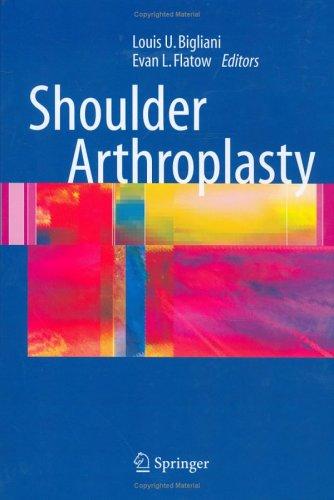 Shoulder arthroplasty