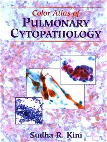 Color Atlas of Pulmonary Cytopathology