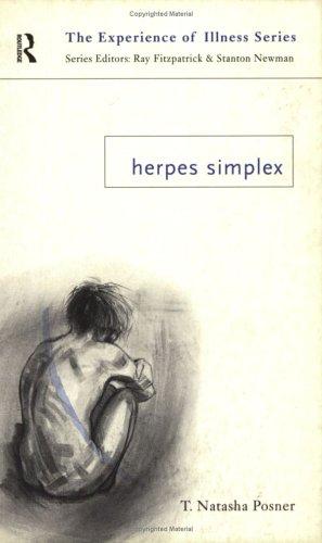 Herpes simplex
