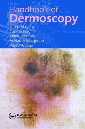 Handbook of dermoscopy