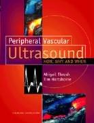 Peripheral Vascular Ultrasound