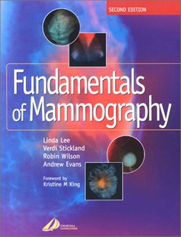 Fundamentals of Mammography