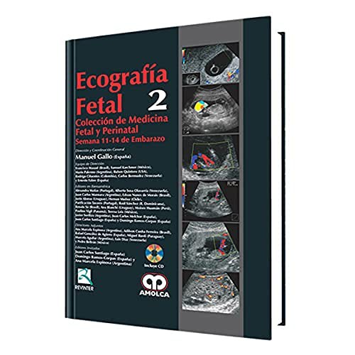Ecografía Fetal No 2