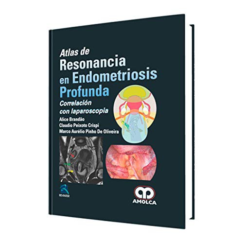 Atlas de Resonancia en Endometriosis Profunda