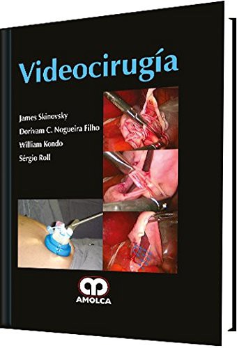 Videocirugía