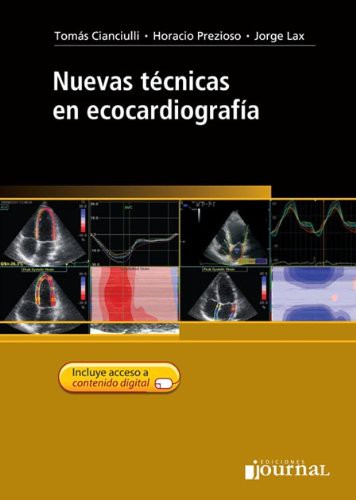 Nuevas tecnicas en Ecocardiografia