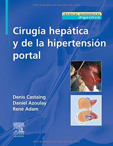 Cirugía hepática y de la hipertensión portal