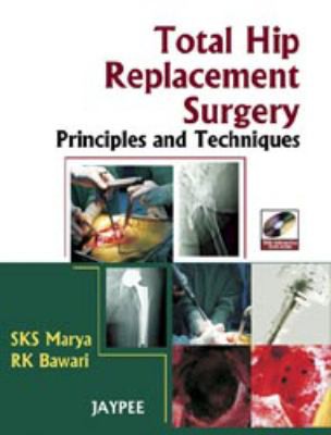 Total hip replacement surgery