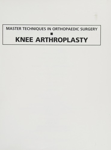 Knee arthroplasty