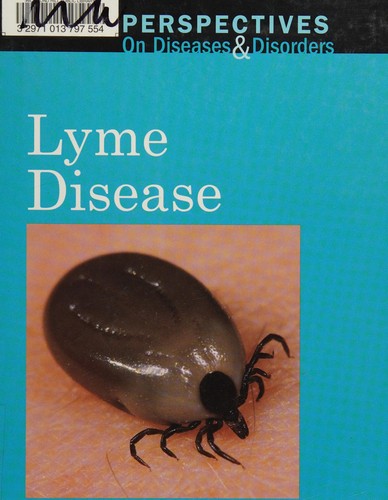 Lyme disease