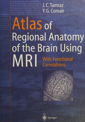 Atlas of regional anatomy of the brain using MRI