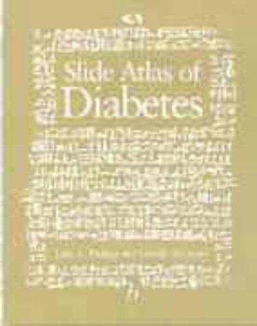 Textbook of diabetes