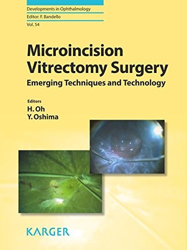 Microincision vitrectomy surgery