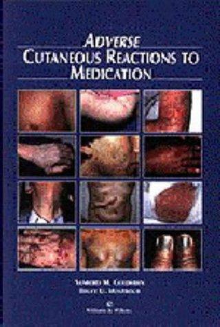 Adverse cutaneous reactions to medication