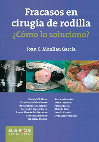 Fracasos en cirugía de rodilla ¿Cómo lo soluciono?