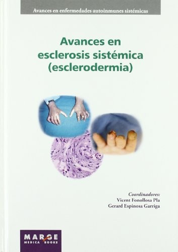 Avances en esclerosis sistémica