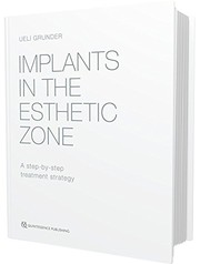 Implants in the Esthetic Zone