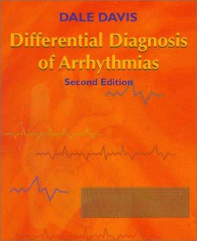 Differential diagnosis of arrhythmias