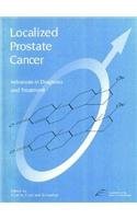 Localized Prostate Cancer