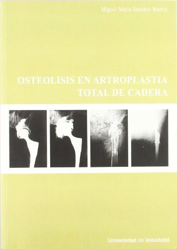 OSTEOLISIS EN ARTROPLASTIA TOTAL DE CADERA