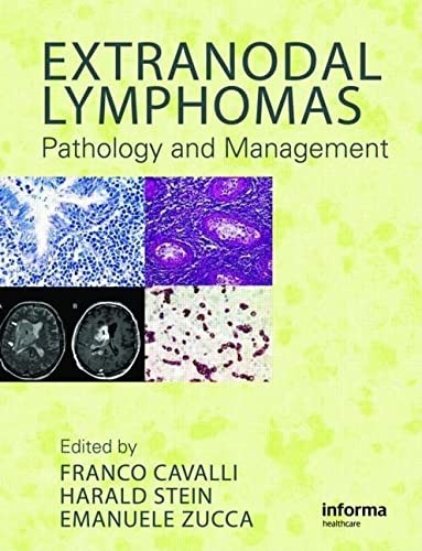 Extranodal Lymphomas