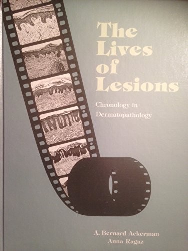 The lives of lesions